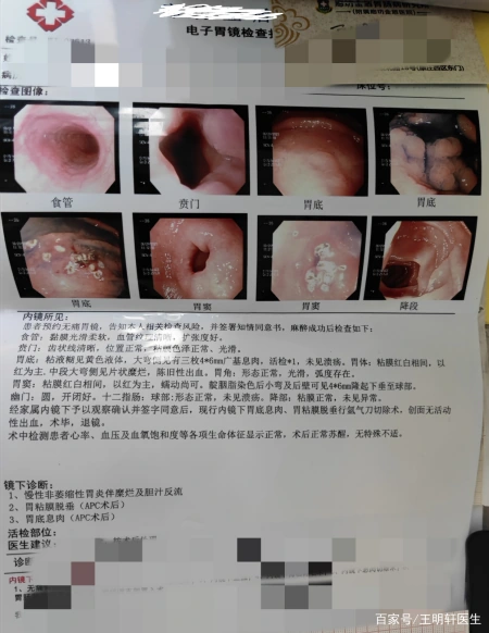 这是一种医生也容易忽略的严重疾病（内科病例）这是一种医生也容易忽略的严重疾病英文，